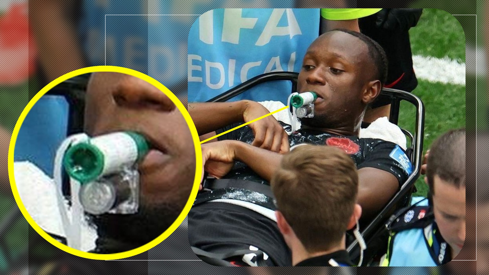 Ce este dispozitivul verde folosit de Ismaël Koné după accidentarea de la Mondialul 2026
