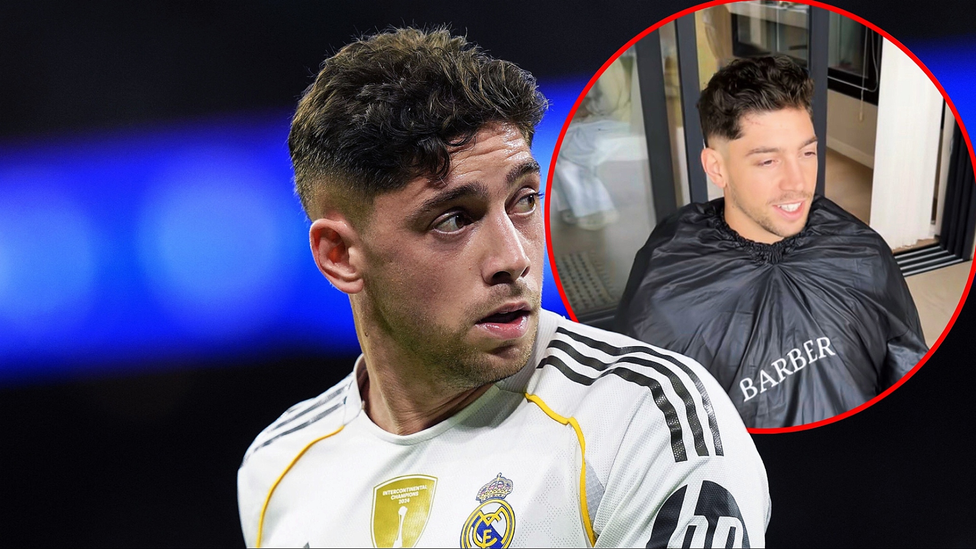 Federico Valverde cu o cicatrice pe frunte după conflictul cu Tchouameni