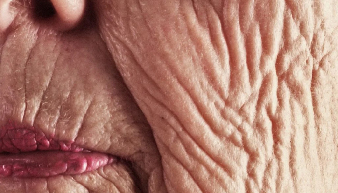 Înghețata comercială, consumată frecvent, accelerează îmbătrânirea pielii prin glicație și inflamație