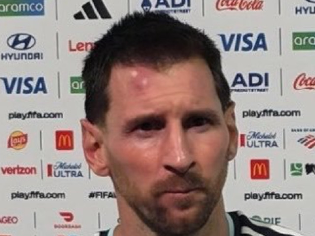 Lionel Messi, cu un cucui în frunte după Argentina - Capul Verde 3-2. A doborât recorduri la Cupa Mondială 2026